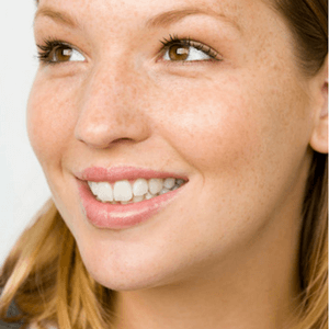 Woman with Invisalign smiling