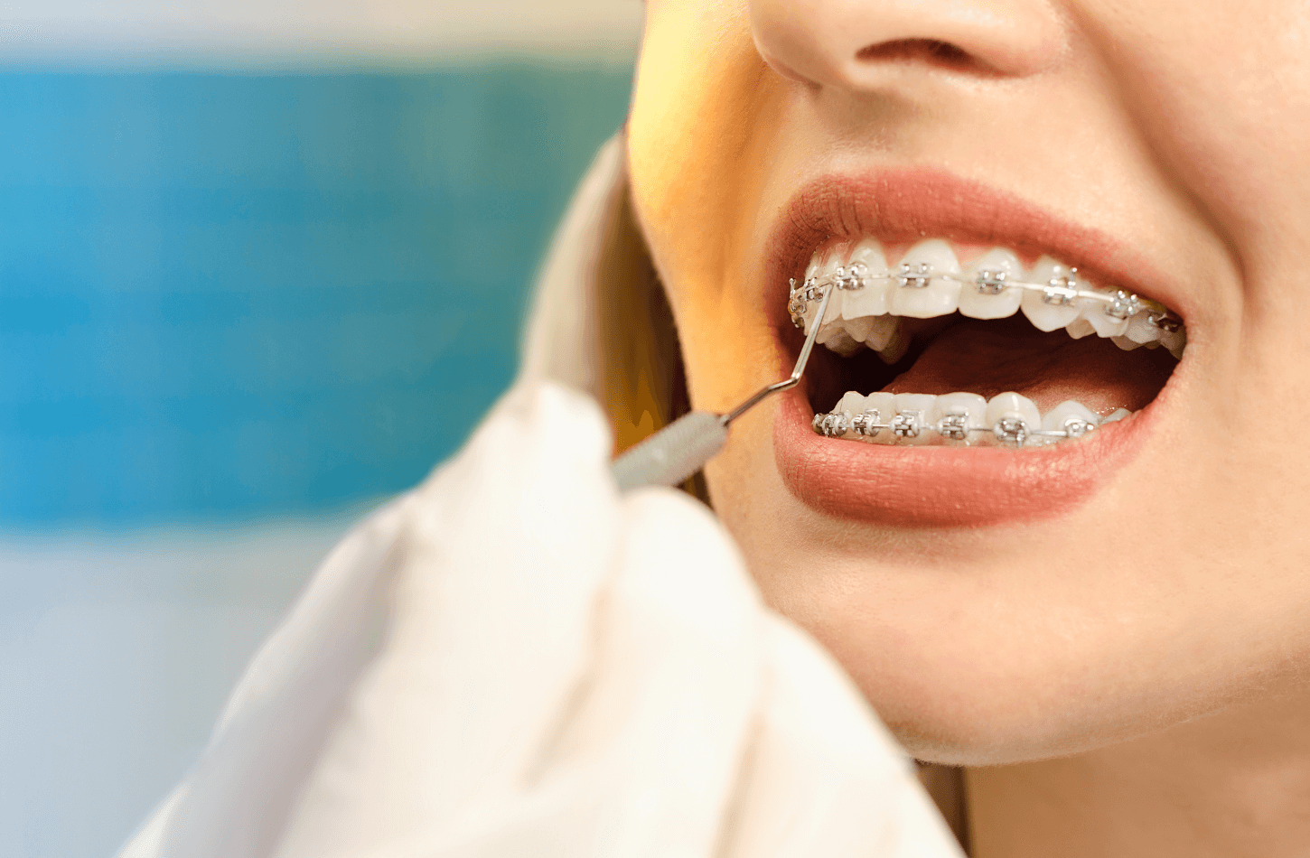 Choosing The Right Braces For You