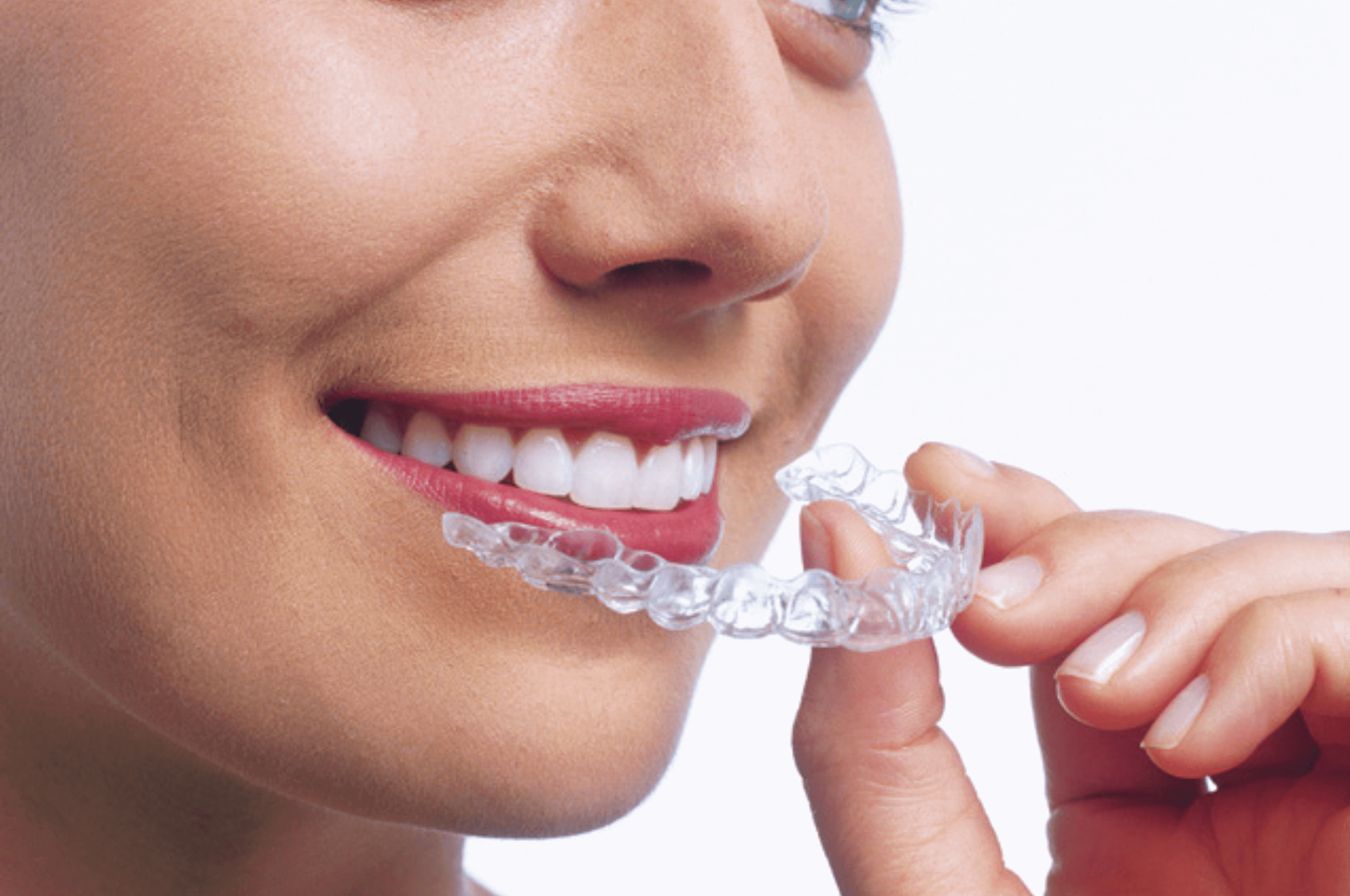 treating bite problems with Invisalign at Arnold Blog