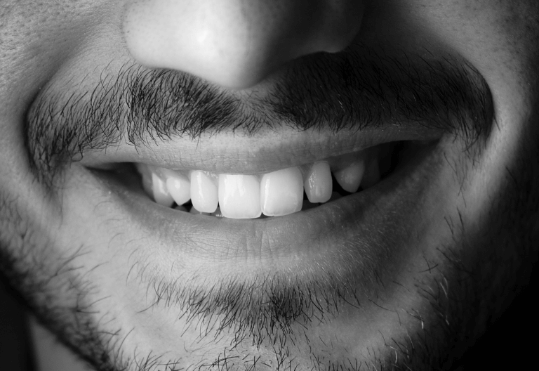 Man with teeth replacement treatment in Arnold, Nottingham