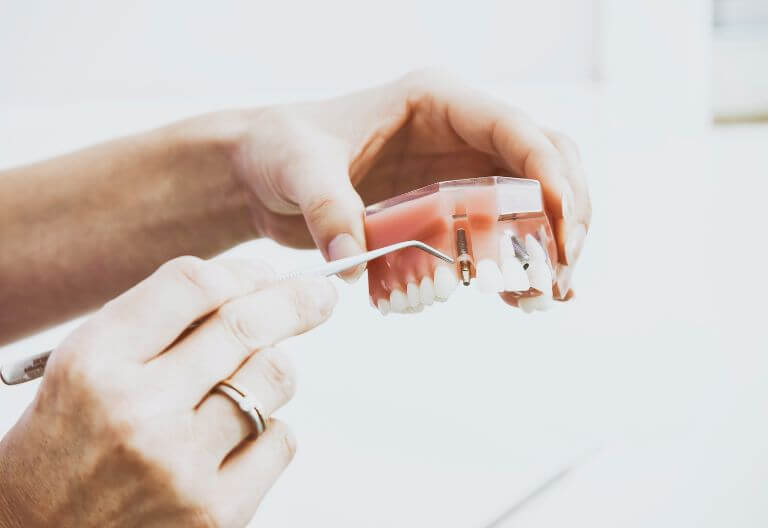 Dental Dentures Display