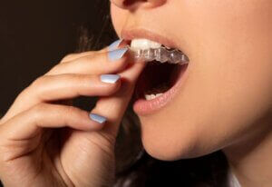 A Woman putting on Invisalign retainers