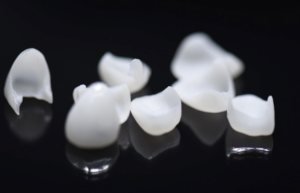 Porcelain veneers.