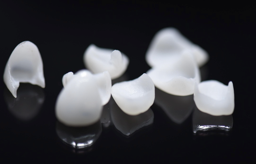 Porcelain veneers. 
