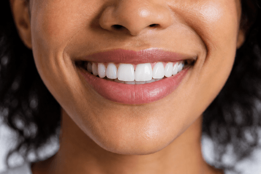 Close-up of a person smiling, showing how veneers transform gap teeth. 
