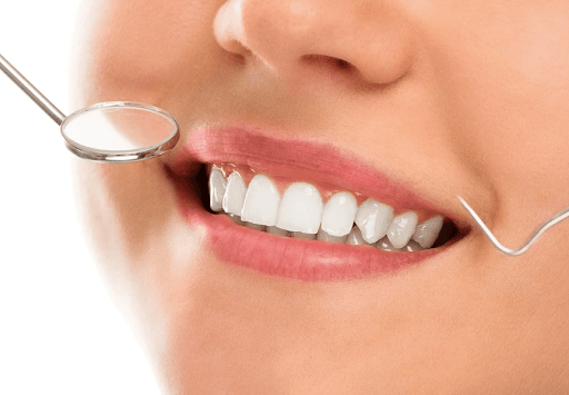 A person smiling after getting dental implants in Nottingham.