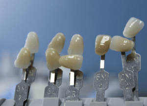 Close-up of different veneers, showing colour variations.