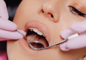 Close-up of a dentist examining a person’s veneers.